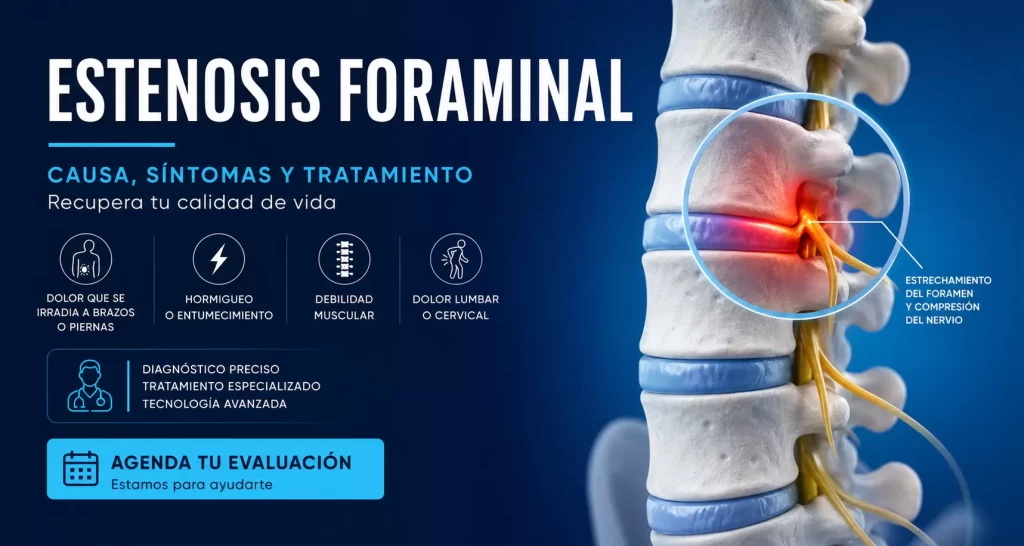 Tratamiento de Estenosis Foraminal en Lima